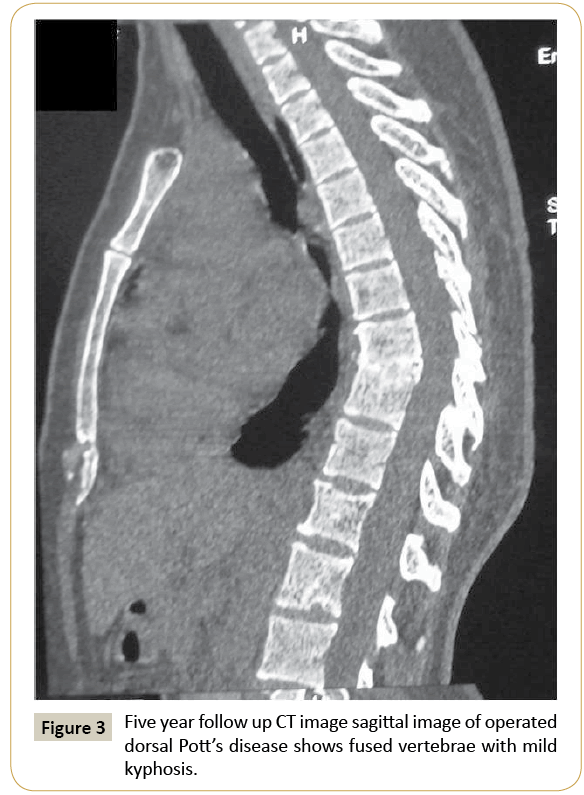 neurosurgery-sagittal-image